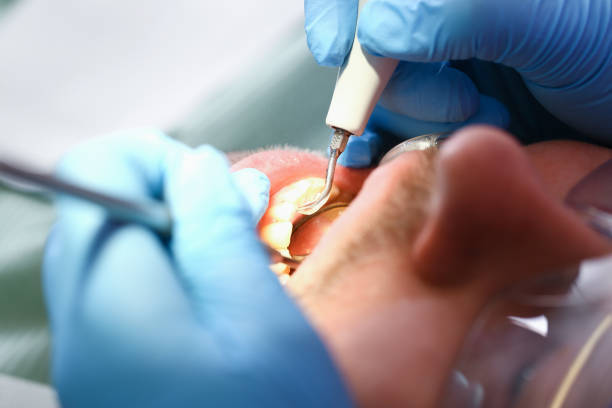 Best Weekend Emergency Dentist in Lexington, SC
