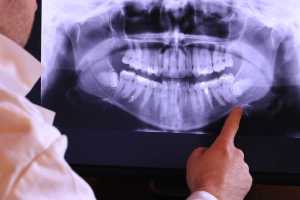 Best Pediatric Emergency Dentist in Lexington, SC